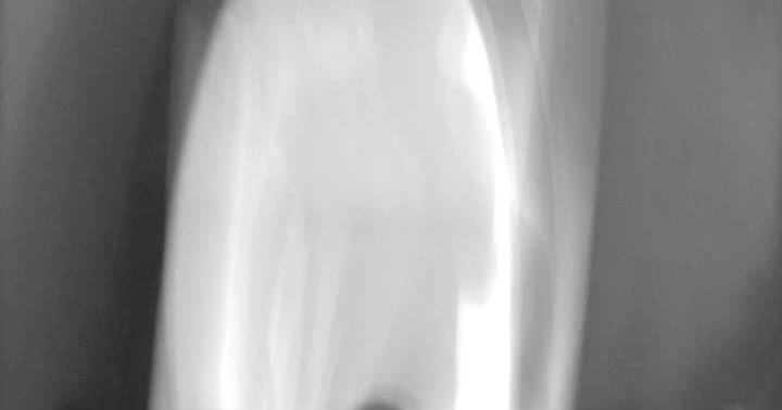 Who Is It? / Qui? / ¿Quién es? / Quem é?