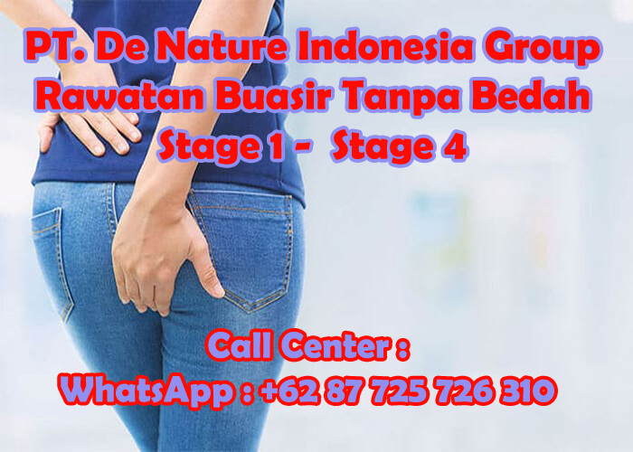 ubat tradisional cina untuk buasir paling dipercayai