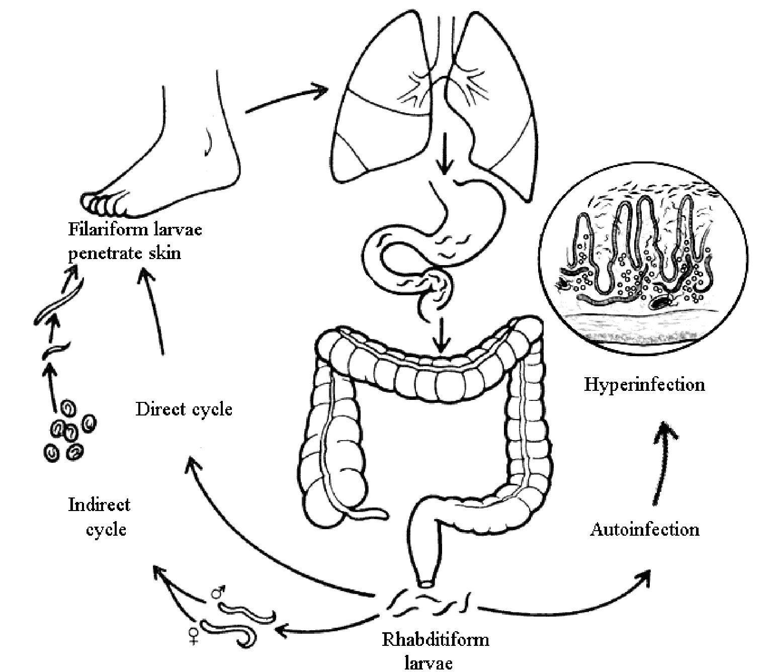 Жизненный цикл угрицы кишечной. Цикл развития угрицы кишечной. Жизненный цикл угрицы кишечной схема. Цикл развития угрицы кишечной схема. Strongyloides stercoralis жизненный цикл.