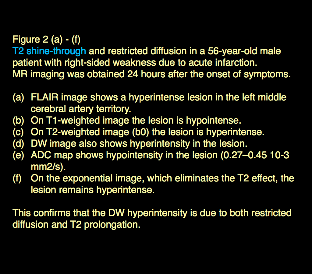 medinria diffusion weighted imaging medinria diffusion weighted imaging