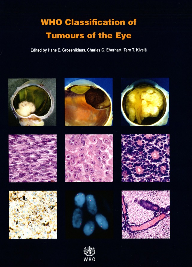 WHO Classification of Tumours of the Eye: WHO Classification of Tumours, Volume 12