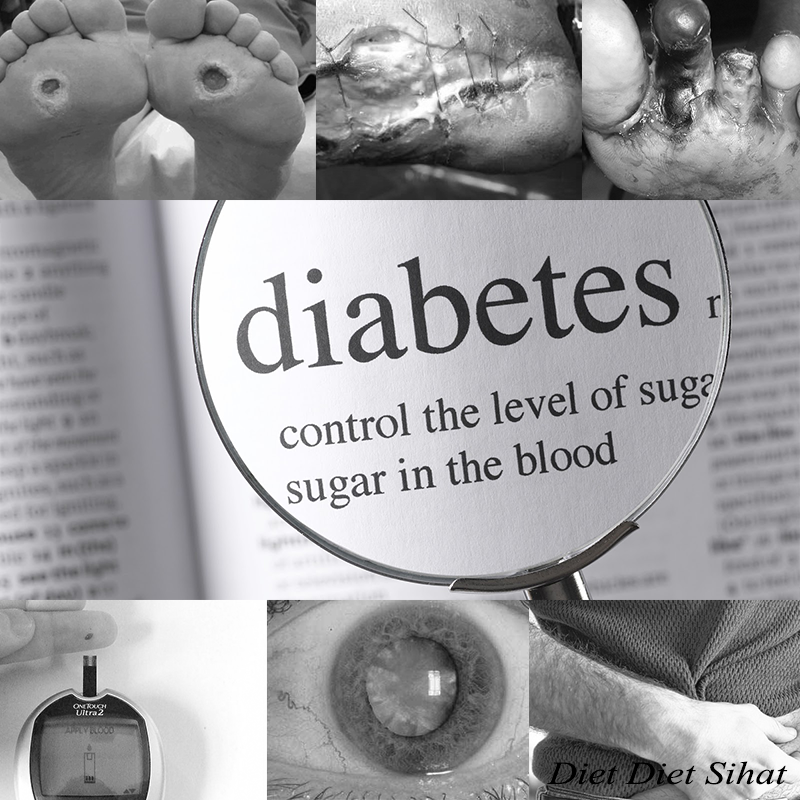ubat diabetes
