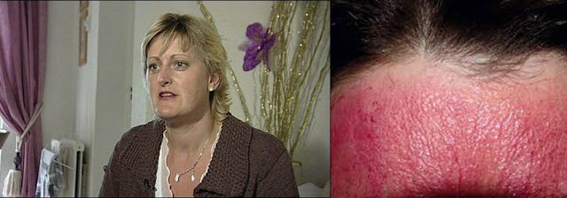 Woow Kelainan dan beberapa fakta manusia unik di dunia Woow Kelainan dan beberapa fakta manusia unik di dunia