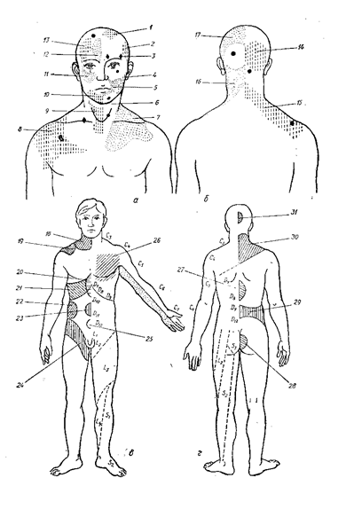 Зоны геда схема. Проекционные зоны Захарьина-Геда схема. Проекционные зоны Захарьина Геда. Зоны Захарьина-Геда схема на лице. Зоны Захарьина-Геда на голове.