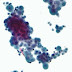 Cytopathologic techniques: Applications and advantages