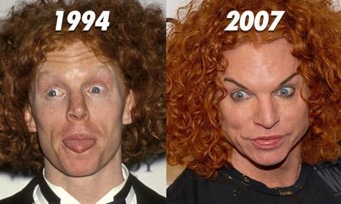 The Crazy Celeb: Plastic Surgery Obsession