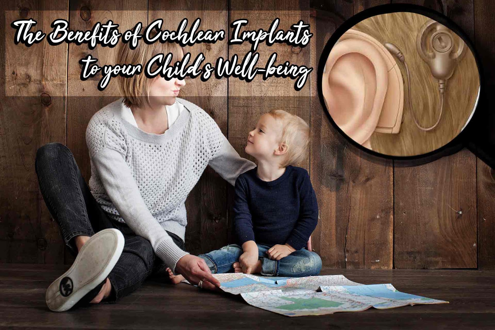4 Major Benefits of Cochlear Implants