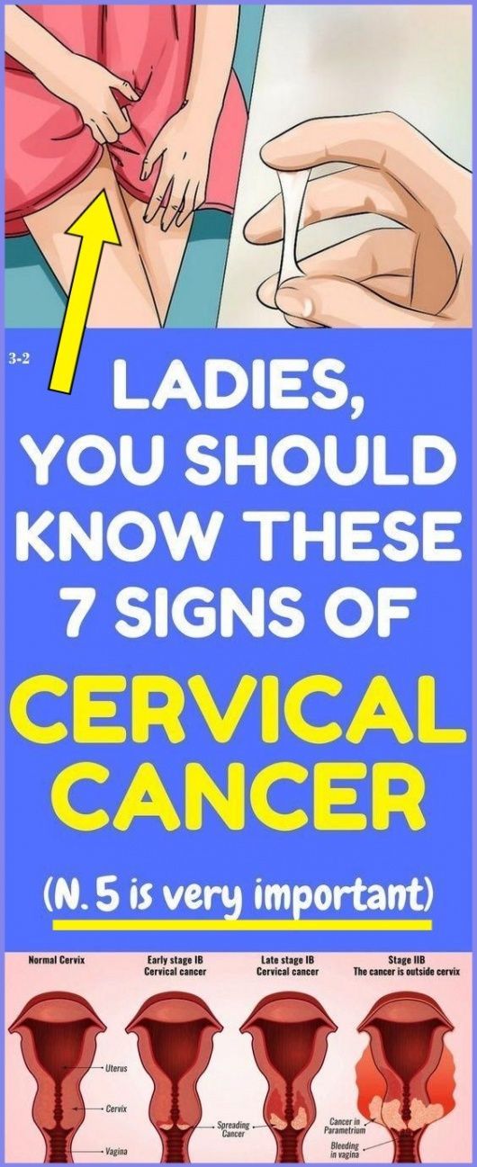 7 Warning Symptoms of Cervical Cancer That Every Women Should Know ...