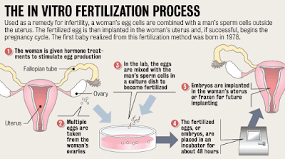 Bayi Tabung atau In Vitro Fertilization Bayi Tabung atau In Vitro Fertilization