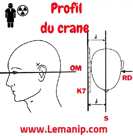 Incidence De Profil Du Crane