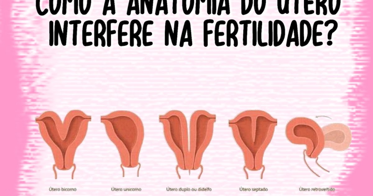 . Como a anatomia do útero interfere na fertilidade?