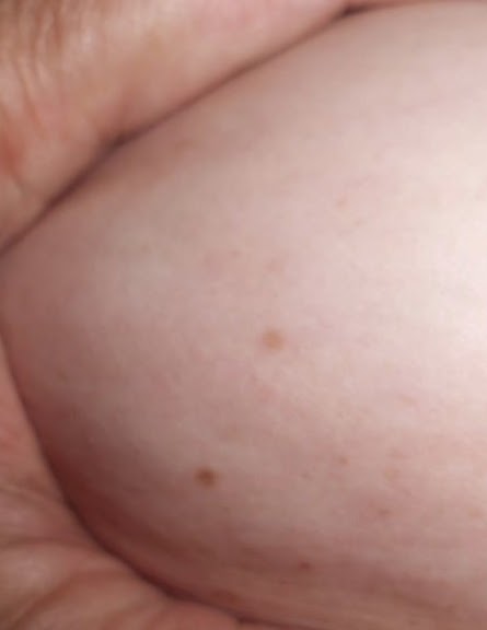 anticelulitico efectivo