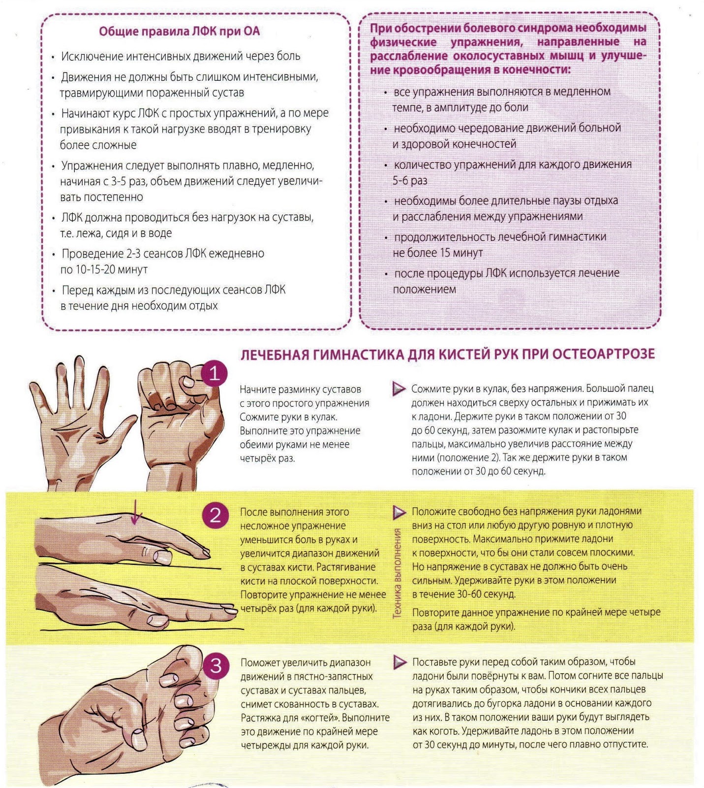Немеют пальцы рук какой врач. Лечебная гимнастика для кистей рук при остеоартрозе. ЛФК при туннельном синдроме лучезапястного сустава руки. Туннельный синдром запястья упражнения. Упражнения для рук при тонельном синдроме.
