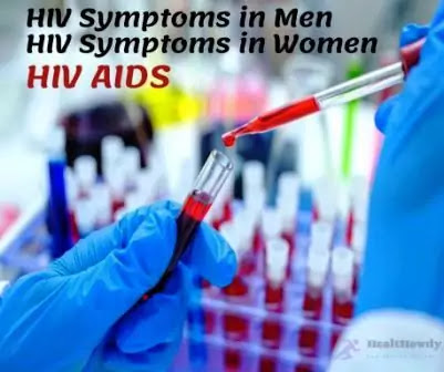 HIV AIDS Symptoms