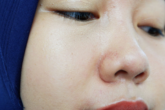 Disini sunscreen ditimpa bedak, jadi patchy