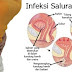 Saluran Kencing Perih Saat Buang Air Kecil