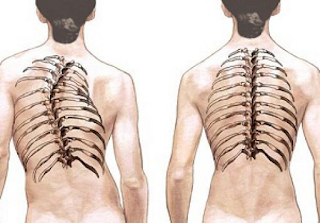 حوادث العظام والعضلات والمفاصل