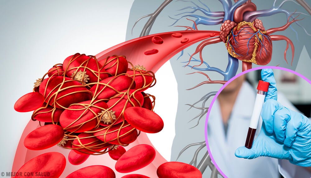 Enfermedades Raras, ¿y eso de qué
