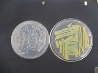 bacteria smear microbiology lab pure unknown found staining preparing sample samples results cultures samantha sarah journal second