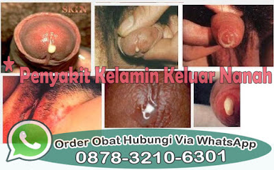 Ramuan Obat Untuk Kencing Nanah 