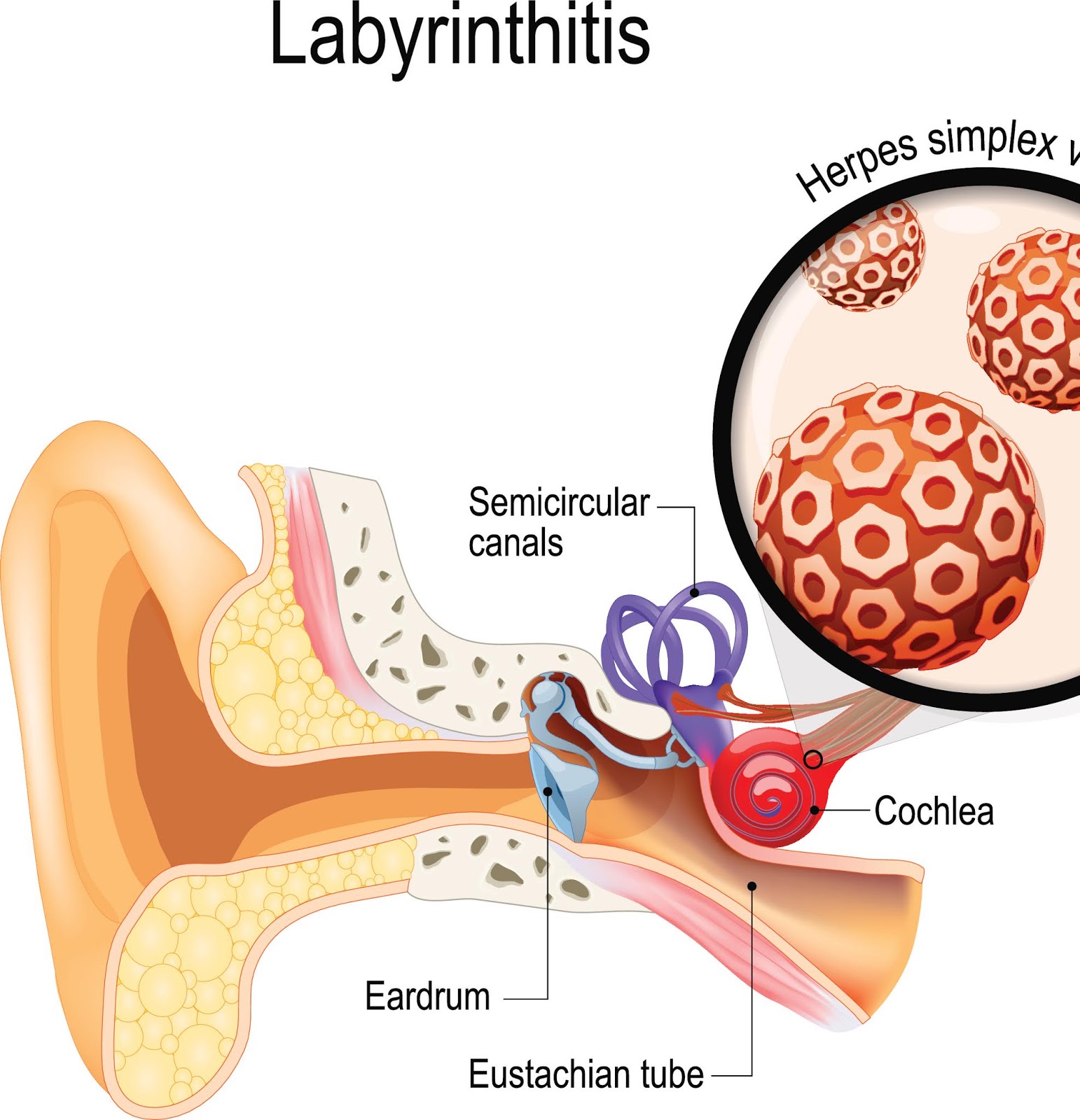 Vertigo and Dizziness..