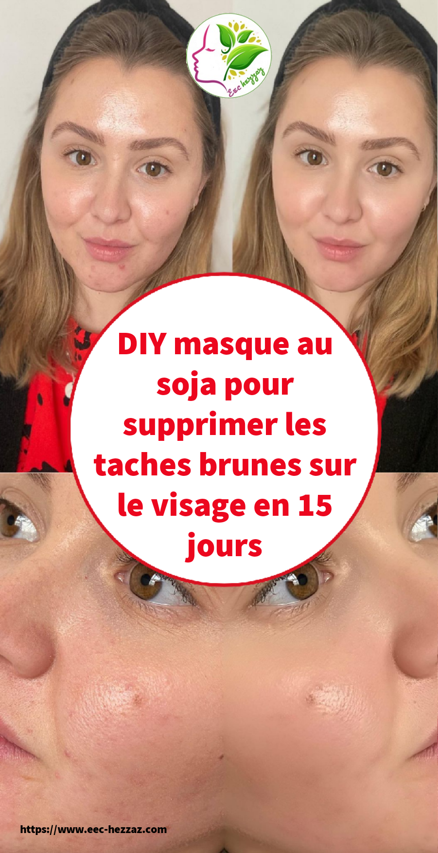 DIY masque au soja pour supprimer les taches brunes sur le visage en 15 jours