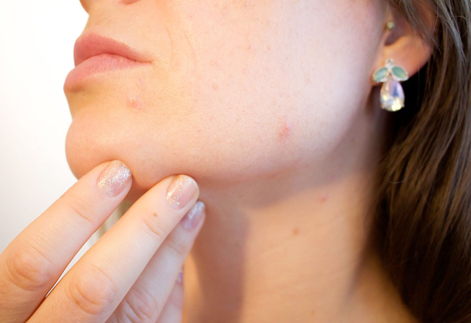 Uses of Cornstarch for Skin Foodnflavor Food Recipe Health