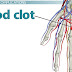 How Does Our Blood Clot? Ever Wonder? 