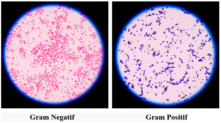 Jurnal Pewarnaan Bakteri Gram Positif Dan Negatif Pdf - Perumperindo.co.id