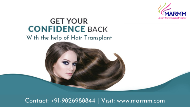 transplant baldnesssolutions101