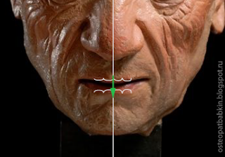 физиологичное открытие рта: нижняя челюсть опускается по средней линии