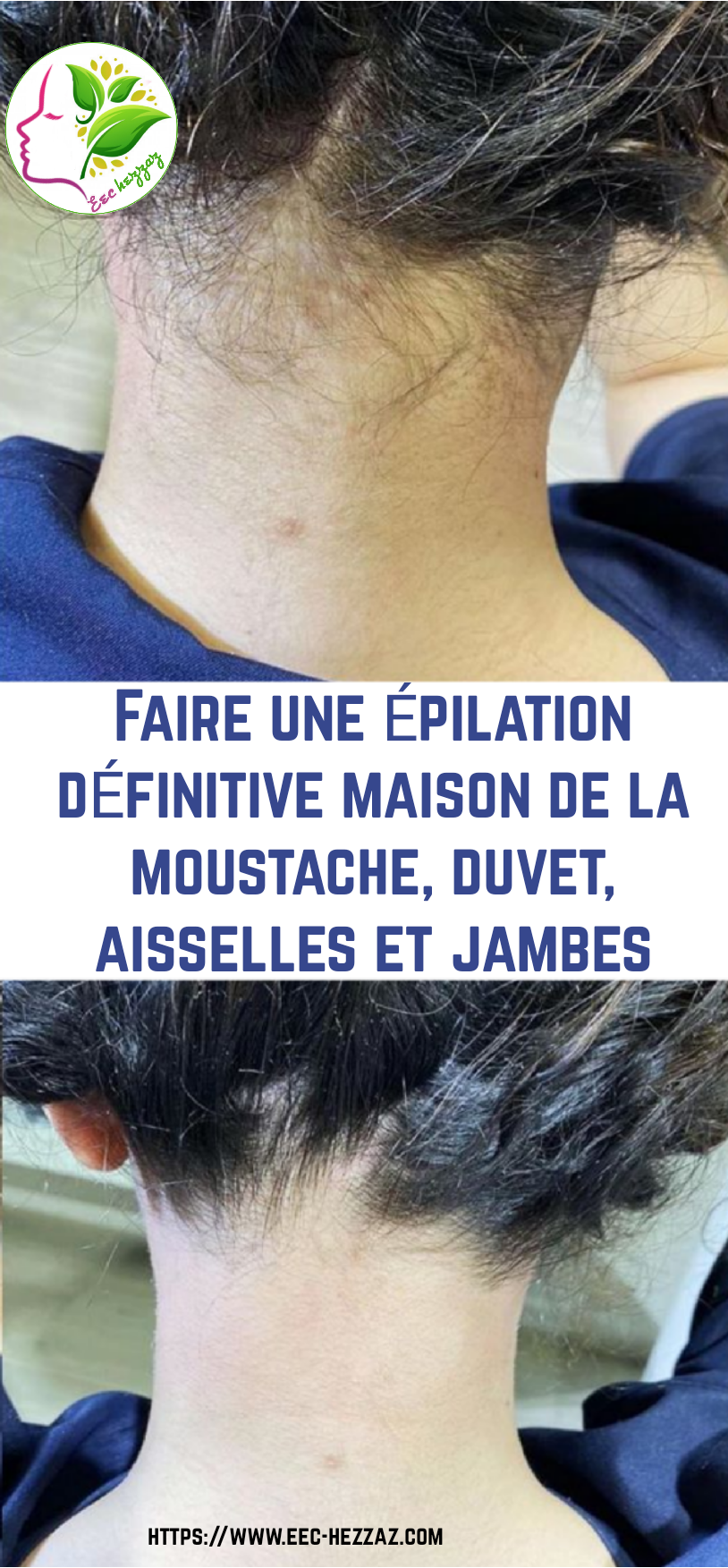 Faire une épilation définitive maison de la moustache, duvet, aisselles et jambes