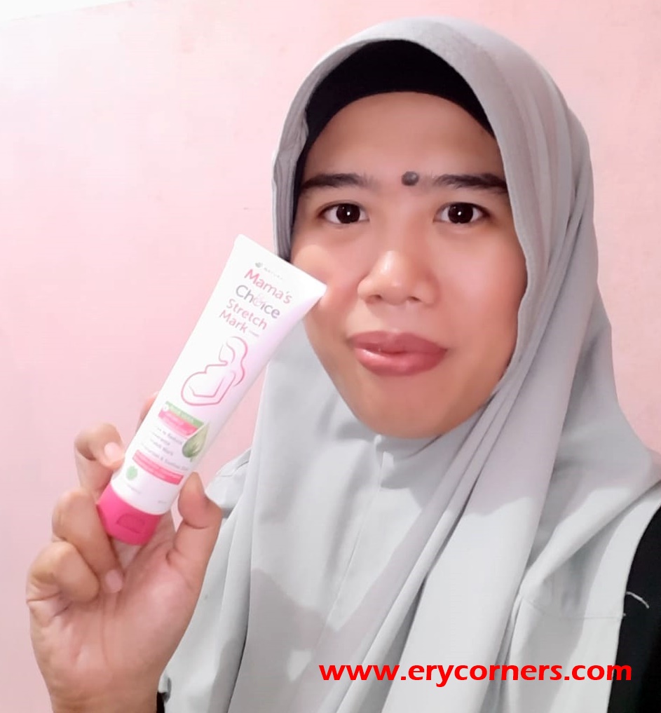 Mama's Choice Stretch Mark Cream Pilihan Tepat untuk Mengusir Stretch