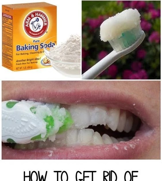 How Do You Remove Hardened Plaque/Tartar from teeth At Home?