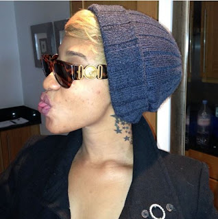 tonto dikeh mosquite bites london