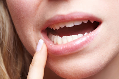 Răng sâu bị nhức bạn phải điều trị ngay-2