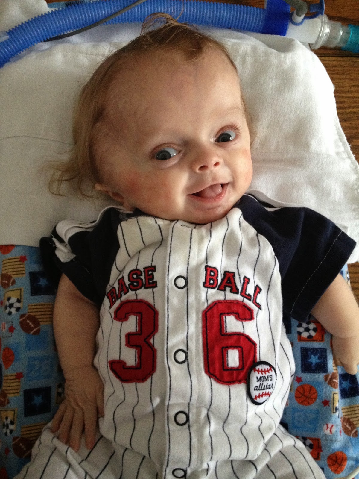 Why Do Babies Wear Helmets All You Need Infos