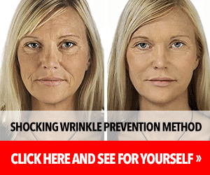 Collagen Select Logo The best collagen on the market!