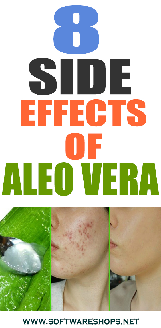 8 Side Effects Of Aloe Vera