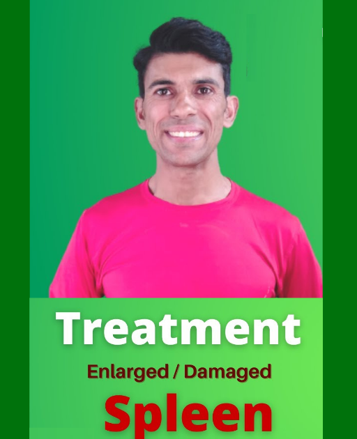 Treatment of Enlarged Spleen without Surgery Krantikari