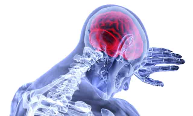 what is brain paralysis symptoms and causes