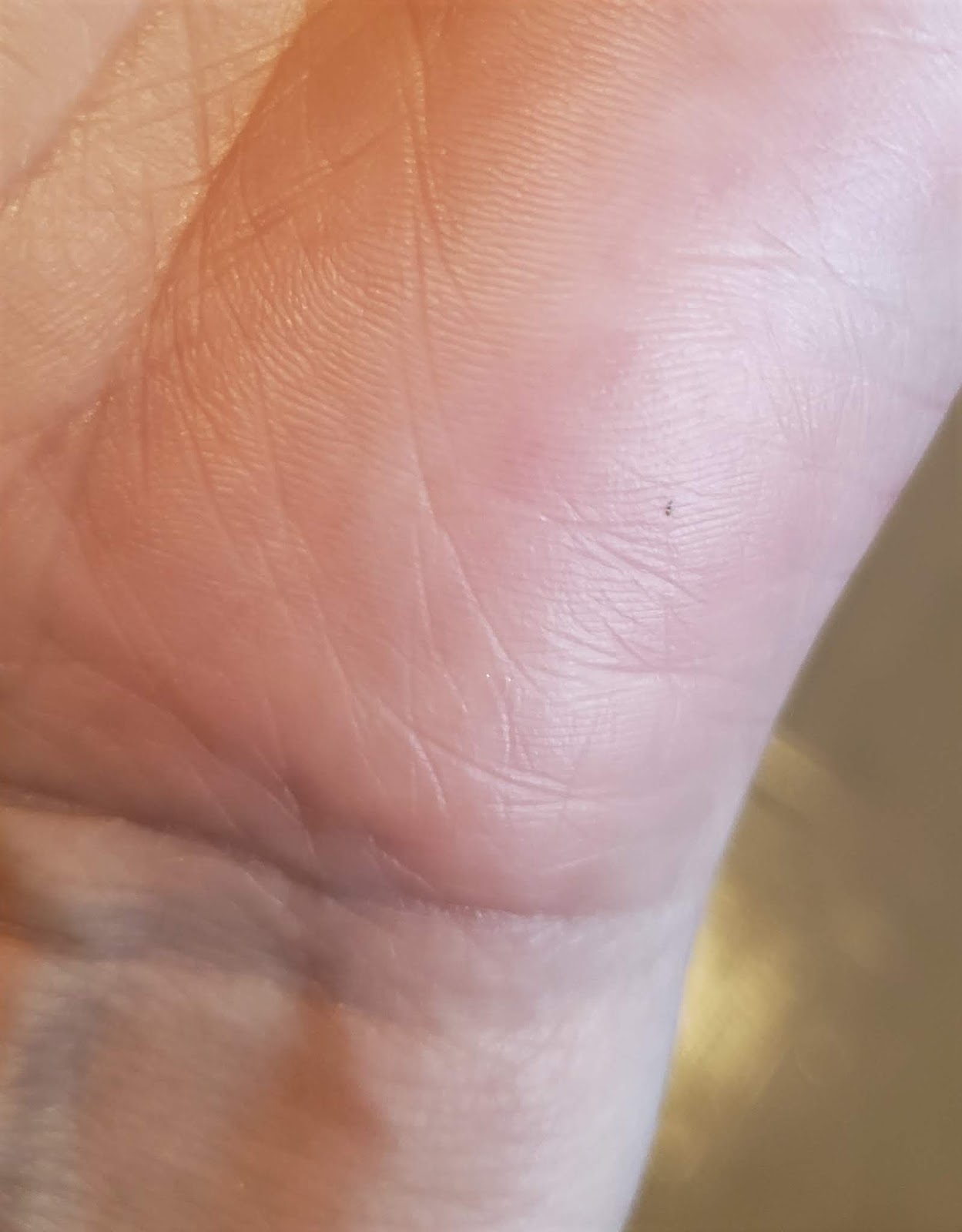 Ancient Remedy Revealed:  Tobacco'S Role In Bee Sting Treatment - nv31fr0