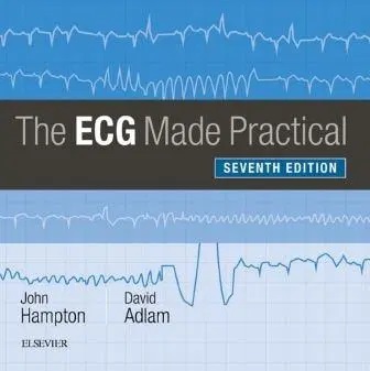 Buku PDF The ECG Made Practical – 7th edition