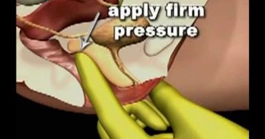 الجي سبوت G Spot حقيقة أم خرافة هل هي موجودة حق ا صحتي الجنسية