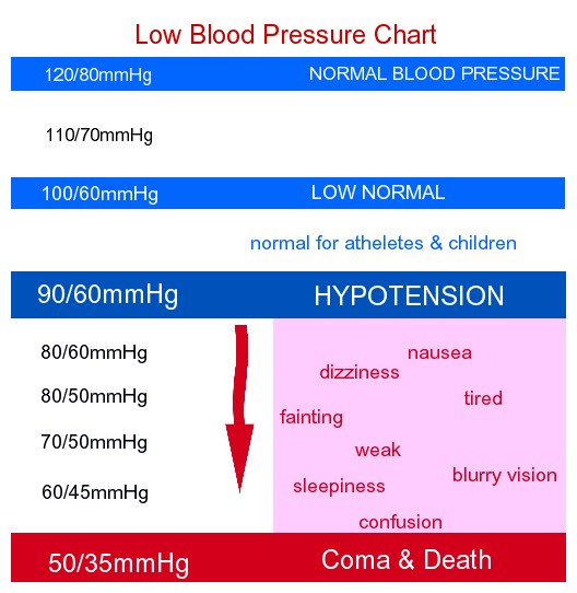 Hypotension blood pressure chart