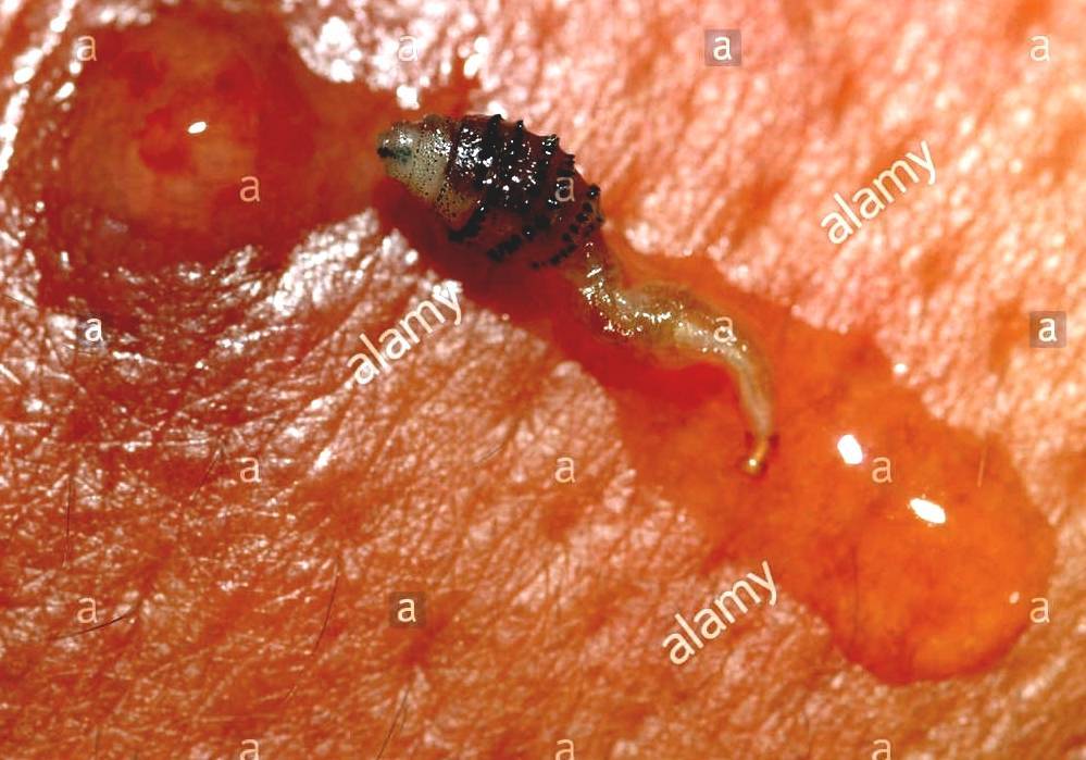 See the source image