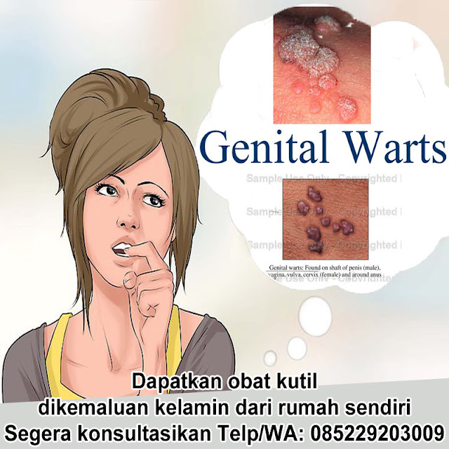 Obat kutil kelamin Obat kutil kelamin