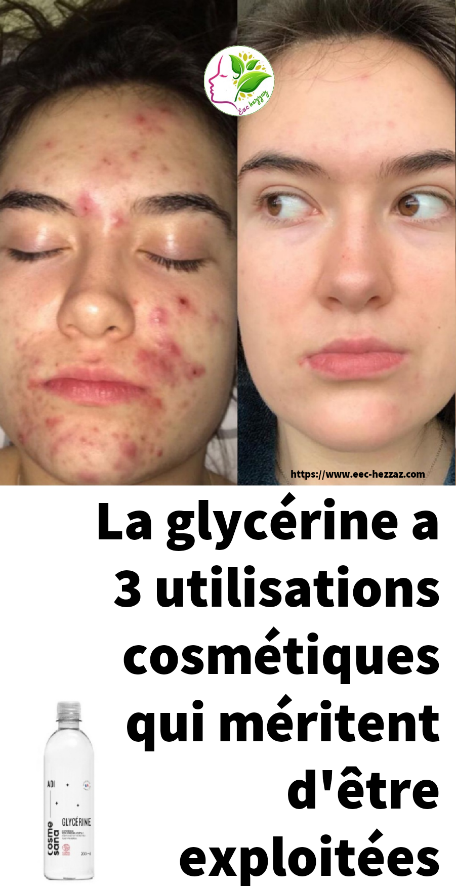 La glycérine a 3 utilisations cosmétiques qui méritent d'être exploitées