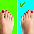 Take a Look at Your Feet and See What They Say About Your Health