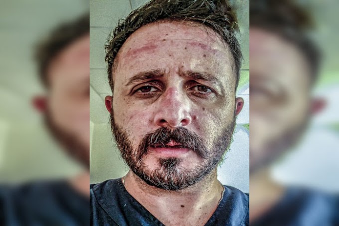 Συγκλονίζει εργαζόμενος σε νοσοκομείο της Κρήτης: Την μάσκα που εσύ αρνείσαι να φορέσεις, εμείς παρακαλάμε να έχουμε